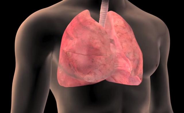 Hronična opstruktivna bolest pluća čest uzrok smrti u Srbiji